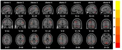 Altered Brain Function in Treatment-Resistant and Non-treatment-resistant Depression Patients: A Resting-State Functional Magnetic Resonance Imaging Study